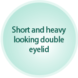 Short and heavy looking double eyelid