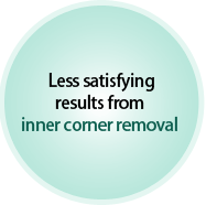 Less satisfying results from inner corner removal
