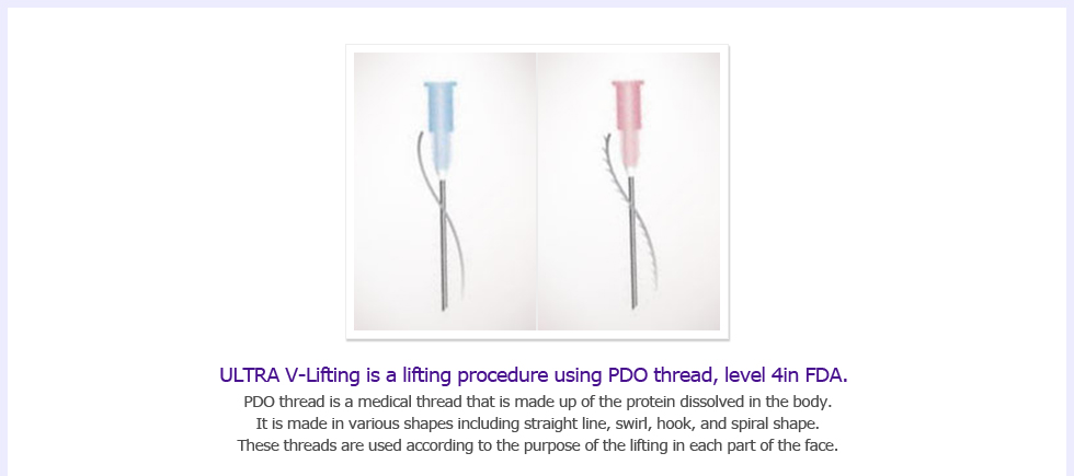 ULTRA V-Lifting is a lifting procedure using PDO thread, level 4in FDA. PDO thread is a medical thread that is made up of the protein dissolved in the body.It is made in various shapes including straight line, swirl, hook, and spiral shape. These threads are used according to the purpose of the lifting in each part of the face.